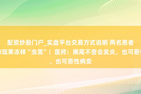 配资炒股门户_实盘平台交易方式说明 两名患者腹内惊现果冻样“虫茧”！医师：阑尾不啻会发炎，也可恶性病变